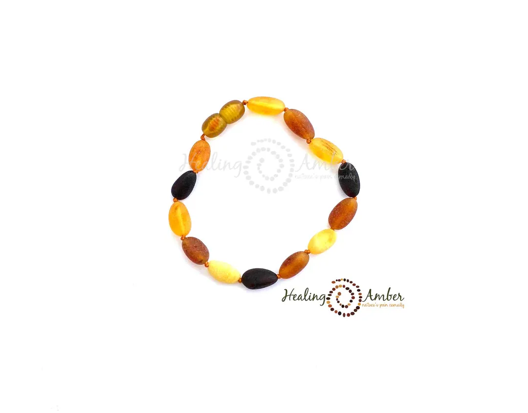 Baltic Amber Bracelet/Anklet Bracelet -7.5"