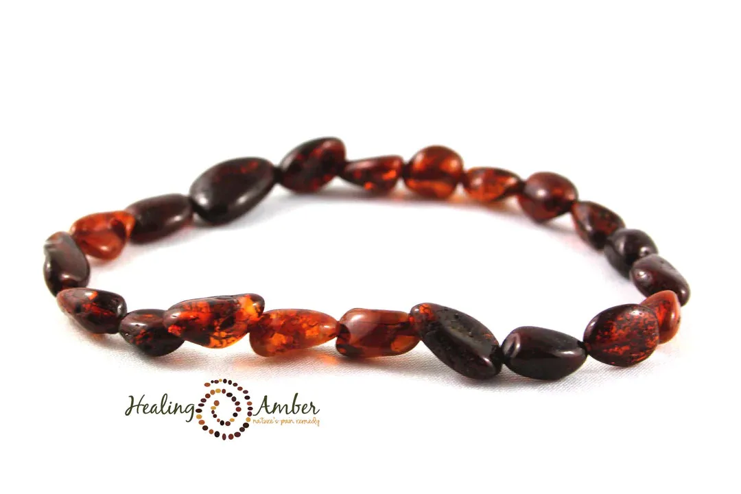 Baltic Amber Bracelet/Anklet Bracelet -7.5"