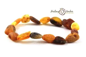 Baltic Amber Bracelet/Anklet Bracelet -7.5"