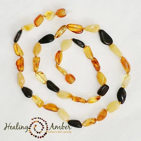 Baltic Amber Bracelet/Anklet Bracelet -7.5"